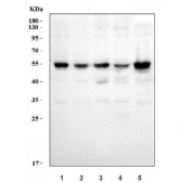 Western blot testing of human 1) 293T, 2) Jurkat, 3) HeLa, 4) HepG2 and 5) U-87 MG cell lysate with ALKBH5 antibody. Predicted molecular weight: ~52 kDa.