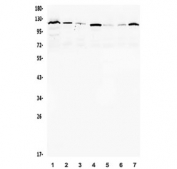 Western blot testing of human 1) K562, 2) U-2 OS, 3) HEK293, 4) PC-3, 5) 22RV1, 6) HepG2 and 7) Caco-2 lysate with AR antibody. Predicted molecular weight ~99 kDa, observed at up to ~120 kDa.
