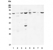 Western blot testing of human 1) HeLa, 2) SK-O-V3, 3) A549, 4) Raji, 5) rat kidney, 6) mouse heart, 7) mouse lung and 8) mouse RAW264.7 lysate with BCAM antibody. Expected molecular weight: 67-90 kDa depending on glycosylation level.