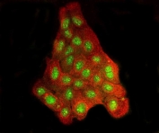 Immunofluorescent staining of FFPE human A431 cells with BRD2 antibody (green) and Tubulin beta mAb (red). HIER: steam section in pH6 citrate buffer for 20 min.