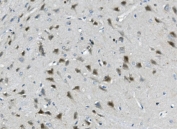 IHC staining of FFPE rat brain with Calbindin 2 antibody. HIER: boil tissue sections in pH8 EDTA for 20 min and allow to cool before testing.
