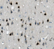 IHC staining of FFPE mouse brain with Calbindin 2 antibody. HIER: boil tissue sections in pH8 EDTA for 20 min and allow to cool before testing.