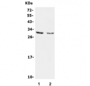 Western blot testing of 1) rat brain and 2) mouse brain lysate with Calbindin 2 antibody. Expected molecular weight: ~29 kDa.
