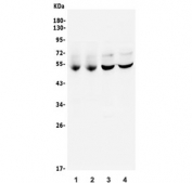 Western blot testing of different lots of rat brain (lanes 1-2) and mouse brain (lanes 3-4) lysate with CAMK II alpha antibody. Predicted molecular weight: ~54 kDa. An additional ~65 kDa band is often observed.