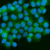 Immunofluorescent staining of FFPE human MCF7 cells with CAMK II alpha antibody (green) and DAPI nuclear stain (blue). HIER: steam section in pH6 citrate buffer for 20 min.