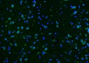 Immunofluorescent staining of FFPE rat brain with CAMK II alpha antibody (green) and DAPI nuclear stain (blue). HIER: steam section in pH8 EDTA for 20 min.