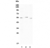 Western blot testing of 1) rat spleen, 2) mouse thymus and 3) mouse NIH 3T3 lysate with CCNB1 antibody. Expected molecular weight: 48-60 kDa.