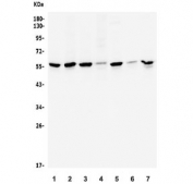 Western blot testing of human 1) HeLa, 2) HEK293, 3) Jurkat, 4) Raji, 5) K562, 6) U-2 OS and 7) Caco-2 lysate with CCNB1 antibody. Expected molecular weight: 48-60 kDa.
