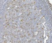 IHC staining of FFPE human tonsil with CCNB1 antibody. HIER: boil tissue sections in pH8 EDTA for 20 min and allow to cool before testing.