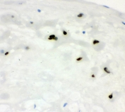 IHC staining of FFPE human placenta with CCNE1 antibody. HIER: boil tissue sections in pH8 EDTA for 20 min and allow to cool before testing.