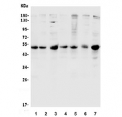 Western blot testing of human 1) HeLa, 2) HepG2, 3) K562, 4) U-2 OS, 5) A549, 6) PANC-1 and 7) Caco-2 antibody with CCNE1 antibody. Predicted molecular weight ~47 kDa.