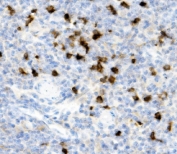 IHC staining of FFPE mouse thymus with Cd79a antibody. HIER: boil tissue sections in pH8 EDTA for 20 min and allow to cool before testing.