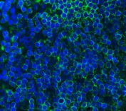 Immunofluorescent staining of FFPE mouse intestinal lymph node cells with Cd79a antibody (green) and DAPI nuclear stain (blue). HIER: steam section in pH6 citrate buffer for 20 min.
