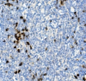 IHC staining of FFPE rat thymus with Cd79a antibody. HIER: boil tissue sections in pH8 EDTA for 20 min and allow to cool before testing.
