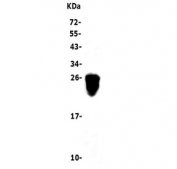 Western blot testing of rat spleen lysate with Cd79a antibody. Expected molecular weight: 25-47 kDa depending on glycosylation level.