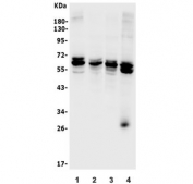 Western blot testing of human 1) HeLa, 2) Caco-2, 3) HeLa, 4) HEK293 and 5) A549 lysate with CDR2 antibody. Expected molecular weight: 52-62 kDa.