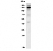 Western blot testing of mouse ANA-1 cells with Il-3rb antibody. Expected molecular weight: 99-130 kDa depending on glycosylation level. 