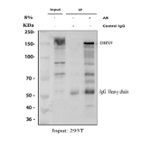 Immunoprecipitation of RNA Helicase A protein from 500ug of human 293T whole cell lysate with 2ug of RNA Helicase A antibody.