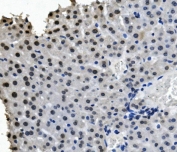 IHC staining of FFPE mouse liver with RNA Helicase A antibody. HIER: boil tissue sections in pH8 EDTA for 20 min and allow to cool before testing.