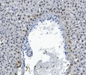 IHC staining of FFPE mouse liver with RNA Helicase A antibody. HIER: boil tissue sections in pH8 EDTA for 20 min and allow to cool before testing.