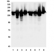 Western blot testing of human 1) HeLa, 2) HEK293, 3) Jurkat, 4) K562, 5) Caco-2, 6) SW620, 7) Raji and 8) A549 lysate with RNA Helicase A antibody. Predicted molecular weight ~140 kDa.