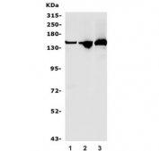 Western blot testing of 1) rat PC-12, 2) mouse brain and 3) mouse RAW264.7 lysate with RNA Helicase A antibody. Predicted molecular weight ~140 kDa.