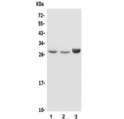 Western blot testing of 1) rat liver, 2) rat kidney and 3) human A549 lysate with DIO1 antibody. Predicted molecular weight ~29 kDa.
