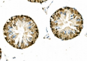 IHC staining of FFPE mouse testis with DNAJA2 antibody. HIER: boil tissue sections in pH8 EDTA for 20 min and allow to cool before testing.