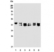 Western blot testing of human 1) placenta, 2) HeLa, 3) COLO-320, 4) Jurkat, 5) HEK293 and 6) K562 lysate with EAPP antibody. Expected molecular weight: 33-45 kDa depending on modification.