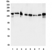 Western blot testing of 1) rat brain, 2) mouse brain, 3) mouse NIH 3T3 and human 4) HeLa, 5) Jurkat, 6) HEK293, 7) PC-3 and 8) ThP1 lysate with EPS15 antibody. Predicted molecular weight ~99 kDa, routinely observed at 120-150 kDa.