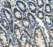 IHC staining of FFPE rat intestine with Gastrotropin antibody. HIER: boil tissue sections in pH8 EDTA for 20 min and allow to cool before testing.