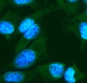 Immunofluorescent staining of FFPE human HeLa cells with FGF10 antibody (green) and DAPI nuclear stain (blue). HIER: steam section in pH6 citrate buffer for 20 min.