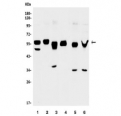 Western blot testing of 1) rat spleen, 2) mouse thymus, 3) mouse RAW264.7, 4) mouse ANA-1, 5) human ThP-1 and 6) human Raji lysate with GFI1 antibody. Expected molecular weight: 47-55 kDa.