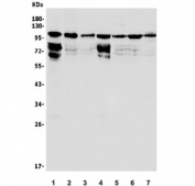 Western blot testing of 1) rat brain, 2) rat PC-12, 3) rat NRK, 4) mouse brain, 5) mouse HEPA1-6, 6) mouse NIH 3T3 and 7) mouse RAW264.7 lysate with HGS antibody. Predicted molecular weight ~86 kDa, commonly observed at 110-115 kDa.