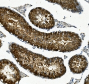 IHC staining of FFPE mouse testis with IFT88 antibody. HIER: boil tissue sections in pH8 EDTA for 20 min and allow to cool before testing.