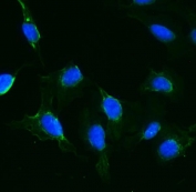 Immunofluorescent staining of FFPE human U-2 OS cells with IFT88 antibody (green) and DAPI nuclear stain (blue). HIER: steam section in pH6 citrate buffer for 20 min.