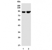 Western blot testing of 1) rat testis and 2) mouse testis lysate with IFT88 antibody. Predicted molecular weight ~94 kDa.