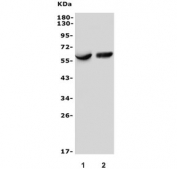 Western blot testing of human 1) Raji and 2) K562 lysate with CD123 antibody. Expected molecular weight: 43-70 kDa depending on glycosylation level.