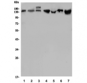 Western blot testing of 1) human HeLa, 2) human Raji, 3) human U-87 MG, 4) rat lung, 5) rat kidney and 6) rat RH35 lysate with LDL Receptor antibody. Expected molecular weight: 95-160 kDa depending on glycosylation level.