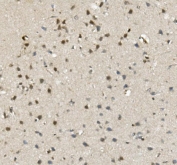 IHC staining of FFPE rat brain with MBD4 antibody. HIER: boil tissue sections in pH8 EDTA for 20 min and allow to cool before testing.
