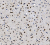 IHC staining of FFPE mouse brain with MBD4 antibody. HIER: boil tissue sections in pH8 EDTA for 20 min and allow to cool before testing.