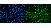 Immunofluorescent staining of FFPE human HeLa cells with MBD4 antibody (green) and DAPI nuclear stain (blue). HIER: steam section in pH6 citrate buffer for 20 min.