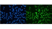 Immunofluorescent staining of FFPE human HeLa cells with MBD4 antibody (green) and DAPI nuclear stain (blue). HIER: steam section in pH6 citrate buffer for 20 min.