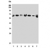 Western blot testing of human 1) A549, 2) Jurkat, 3) SK-O-V3, 4) Raji, 5) HeLa, 6) A431 and 7) MDA-MB-453 lysate with MBD4 antibody. Predicted molecular weight ~66 kDa.