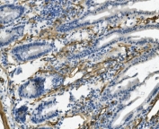 IHC staining of FFPE mouse intestine with Cd146 antibody. HIER: boil tissue sections in pH8 EDTA for 20 min and allow to cool before testing.