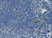 IHC staining of FFPE rat spleen with Cd146 antibody. HIER: boil tissue sections in pH8 EDTA for 20 min and allow to cool before testing.