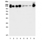 Western blot testing of rat 1) lung, 2) ovary, 3) PC-12 and mouse 4) lung, 5) spleen, 6) thymus, 7) kideny and 8) ovary lysate with Cd146 antibody. Expected molecular weight: 72-130 kDa depending on glycosylation level.