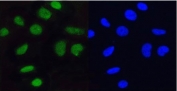 Immunofluorescent staining of FFPE human HeLa cells with MCM5 antibody (green) and DAPI nuclear stain (blue). HIER: steam section in pH6 citrate buffer for 20 min.