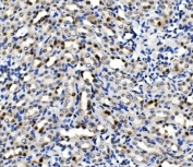 IHC staining of FFPE rat kidney with MCM5 antibody. HIER: boil tissue sections in pH8 EDTA for 20 min and allow to cool before testing.