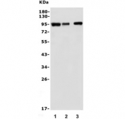 Western blot testing of 1) human Jurkat, 2) rat thymus and 3) mouse thymus lysate with MCM5 antibody. Expected molecular weight: 80-90 kDa.